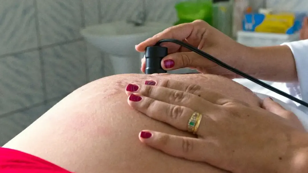 Assistência ao parto avança no Brasil, mas ainda há Desafios no pré-natal