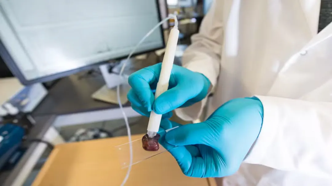 MasSpec Pen: brasileira cria caneta que detecta câncer em 10s