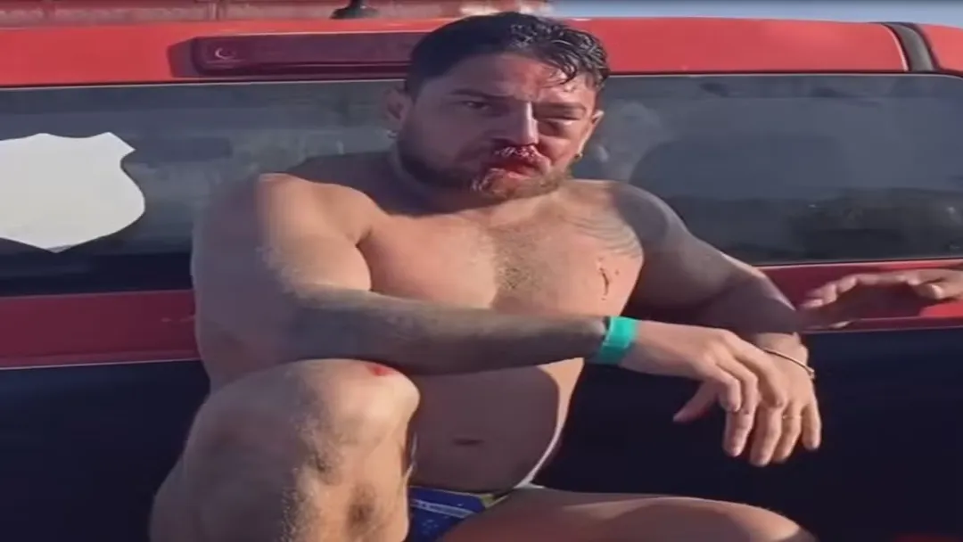 Turistas de MT são agredidos em Porto de Galinhas após briga por preço de cadeira