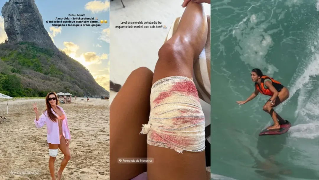 Turista é mordida por tubarão em Fernando de Noronha