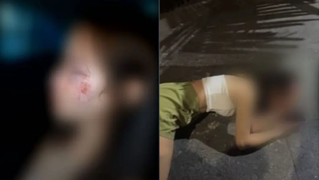 Mulher é agredida em beco no Jardim Guanabara após emboscada