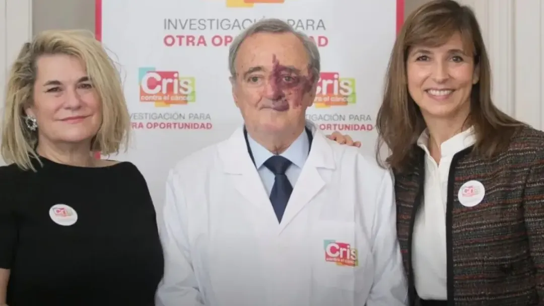 Cientistas Eliminam Câncer de Pâncreas com Terapia Tripla