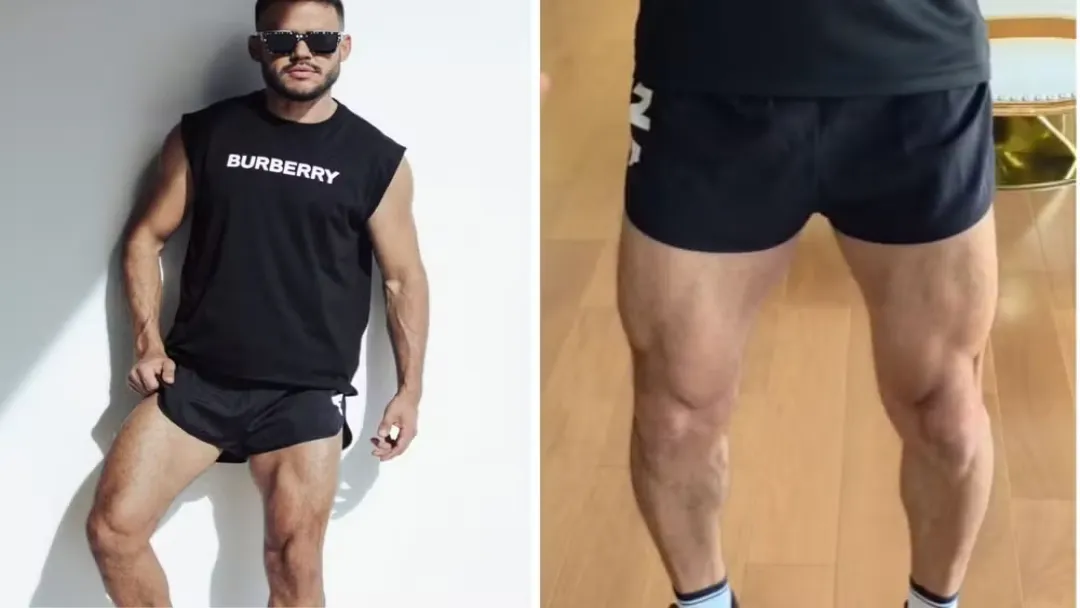 Aluno advertido por uso de short em academia receberá R$ 20 mil de indenização