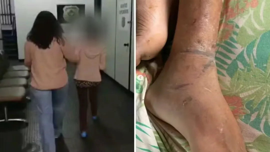 Homem acorrentado pela mãe sofreu três AVCs