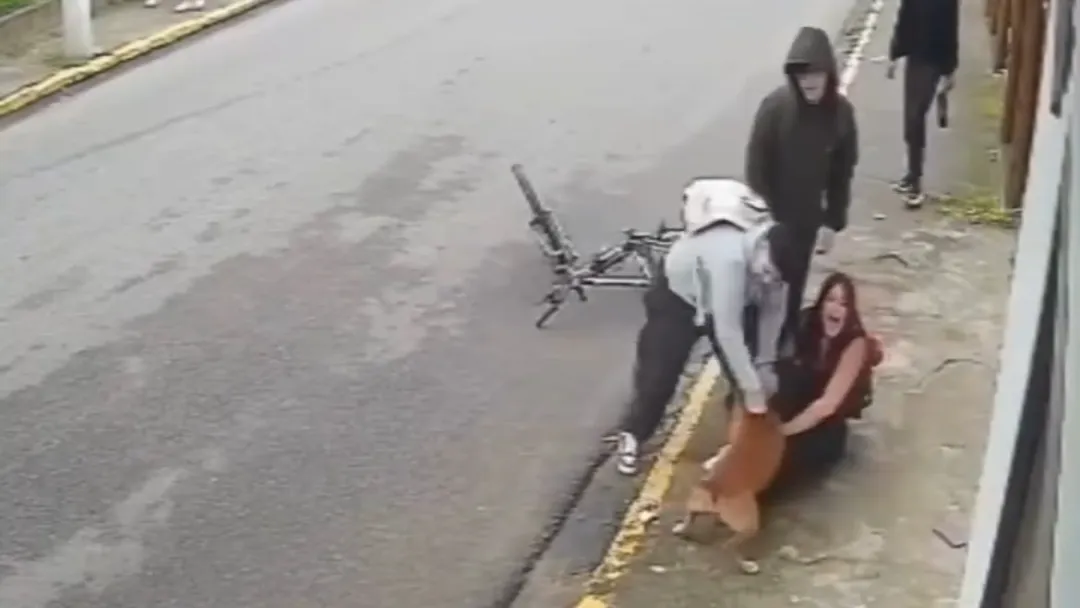 Jovem é atacada por pitbull em rua de Santa Catarina e sofre ferimentos profundos