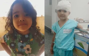 Menina de 4 anos é atacada por pit bull dentro de casa em Goiânia