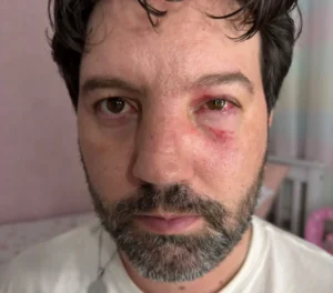 Jornalista é agredido por jogador após partida